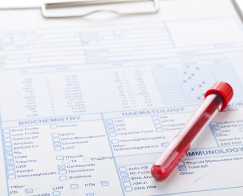 Blood Test
